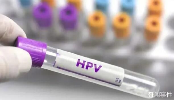 男童喉嚨長菜花樣腫塊確診感染HPV 小小年紀怎么會和HPV扯上關系