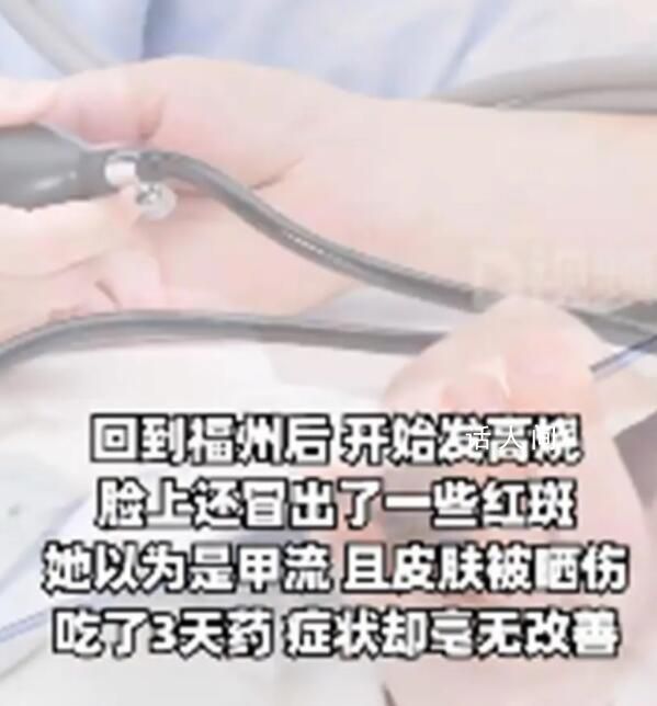 女子旅游后高燒不退確診不死癌癥 紅斑狼瘡是怎么引起的