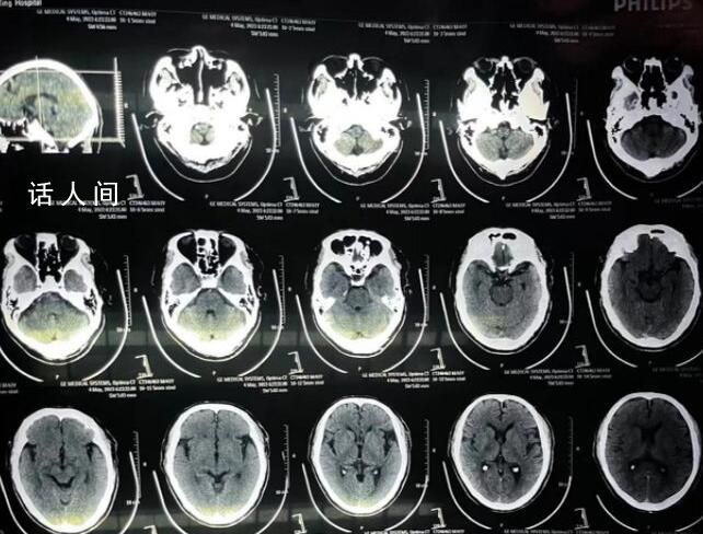 醫(yī)生謊稱手術(shù)成功致患者身亡 醫(yī)生：手術(shù)失敗怕打臉