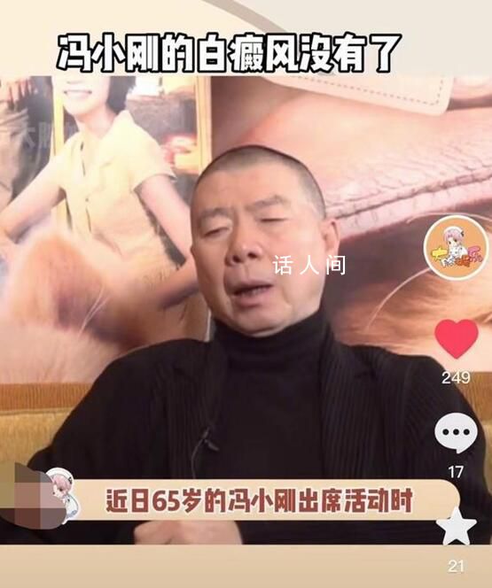 馮小剛多年的白癜風“消失”了 這病真的能治好嗎