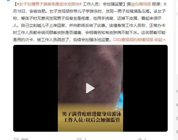 女子吐槽男子滿背疙瘩進(jìn)泳池游泳 用手撓背還掉下皮屑看起來很嚇人