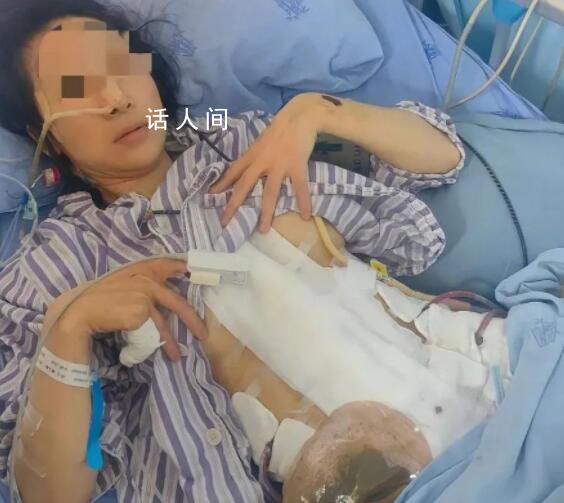 婦聯回應女子2年被老公家暴16次 引起廣泛關注