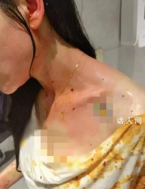 女主播遭家暴內臟破裂 丈夫被刑拘