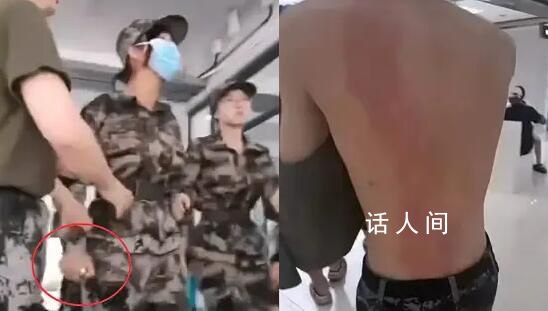 女生用小噴霧器燙傷男生 高?；貞?yīng)