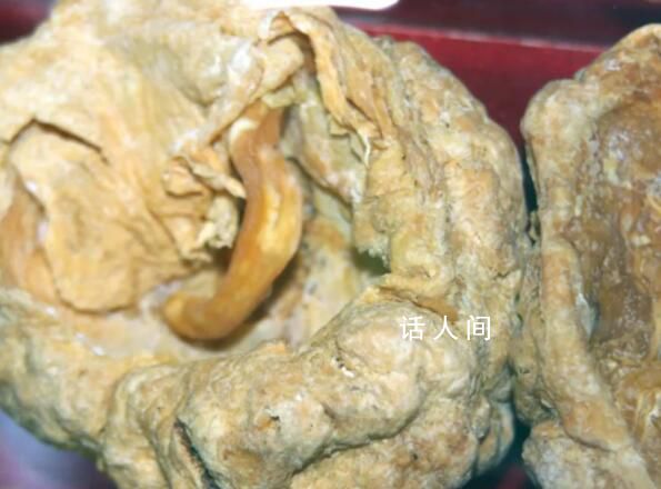 代表建議允許產婦胎盤捐獻給藥企 回應：支持探索