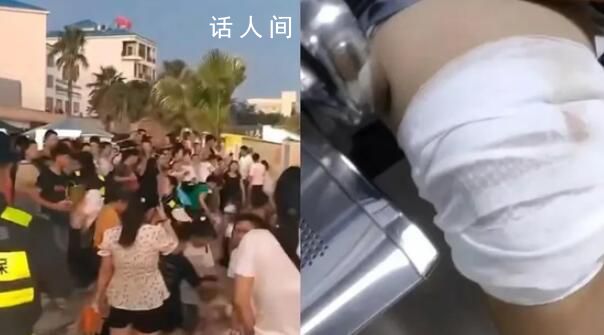 北海被魚咬傷者稱曾踩到軟軟的東西 親友11歲的孩子不慎被咬傷