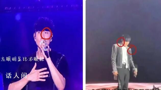 林俊杰被激光筆照眼 嚴重致失明