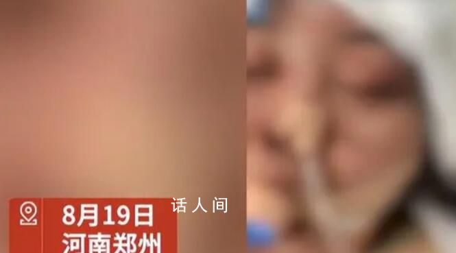 女子沒給丈夫錢充手游被毆打失明 目前警方已經介入調查