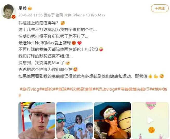 吳尊曬照稱陪兒女打籃球臉部受傷 鼻子處的傷口不停往下流血
