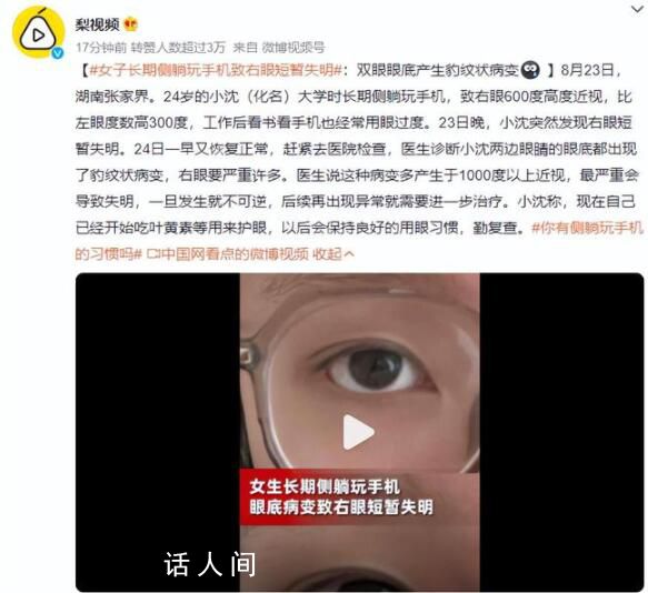 女子長期側躺玩手機致右眼短暫失明 兩邊眼睛的眼底都出現了豹紋狀病變