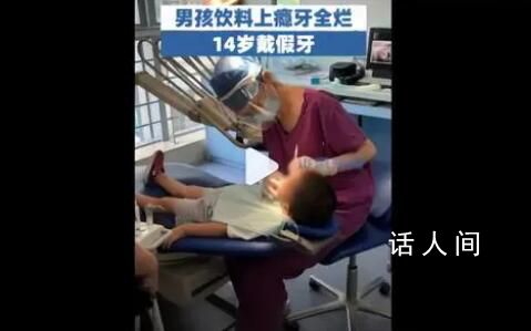 男孩喝飲料上癮牙全爛14歲戴假牙 可樂雪碧卻要連喝三瓶