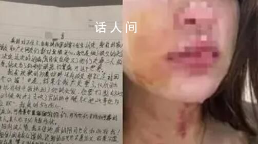 女子被夫婦毆打扒衣后吞安眠藥自殺 送醫(yī)后已搶救回來(lái)