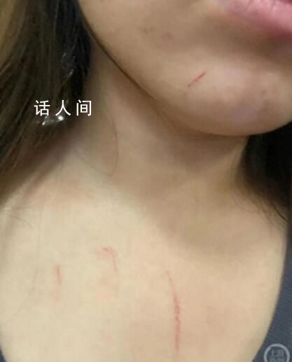 高鐵拒換座被打女子:對方先動手