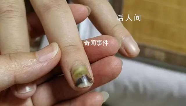 19歲女子被騙緬甸獲救時遍體鱗傷 警方將進一步對該案涉及的緬北詐騙窩點深挖徹查