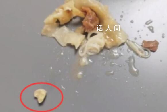 孩子在云吞中吃出牙齒?家長投訴