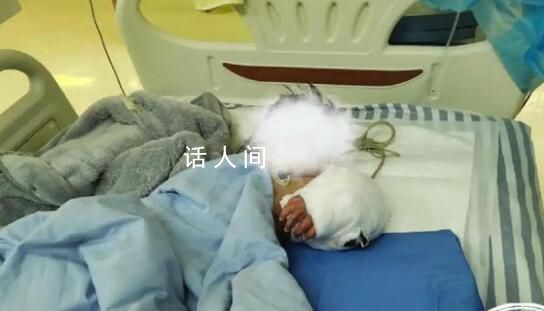 男童手臂伸進籠子被藏獒咬斷 經過6個小時的手術成功接上