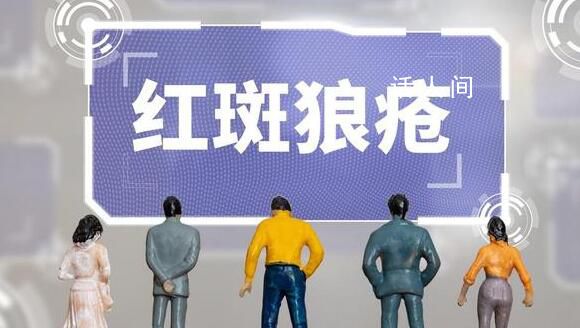 紅斑狼瘡被稱“不死的癌癥” 該病尚無法根治