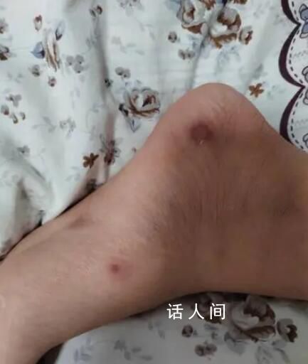 家長稱學校無取暖設施孩子手腳凍爛 學校目前處于停課狀態(tài)