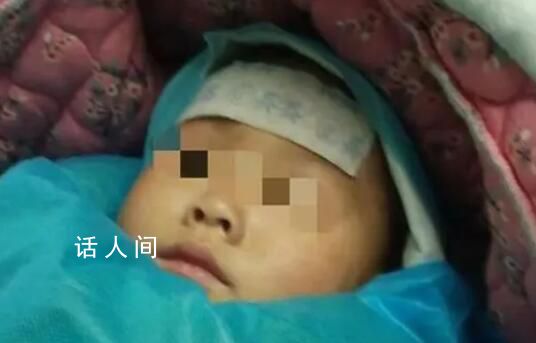 4歲女童被3只狗咬掉大半頭皮 已在重癥監(jiān)護室治療一個月