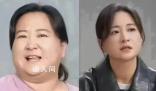 醫生稱賈玲式減肥要有診療團隊 即便做減重手術也很難達到這個效果