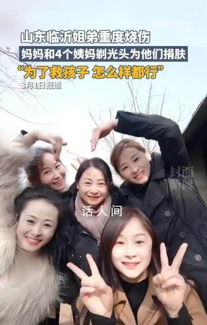 姐弟燒傷四位姨媽剃光頭捐頭皮 為了救孩子怎么樣都行